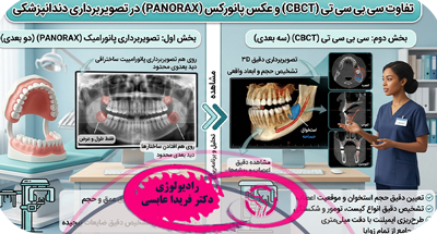 تفاوت CBCT و عکس پانورامیک دندان چیست؟ کدام بهتر است؟