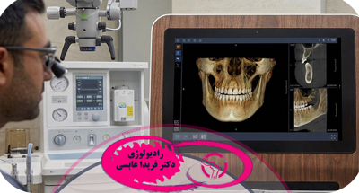 دندان عقل کج چه مشکلاتی ایجاد می‌کند؟ علائم، عوارض و روش تصویربرداری