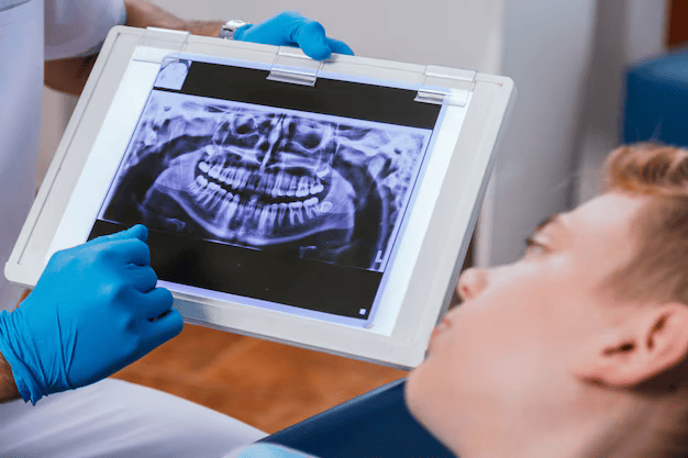مقایسه دقت توموگرافی کامپیوتری با پرتو مخروطی (CBCT) و رادیوگرافی دیجیتال بایت‌وینگ در تشخیص پوسیدگی